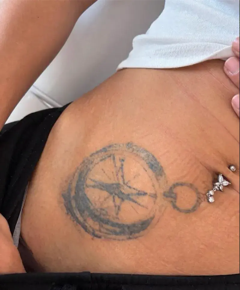 Détatouage en cours à Cannes : tatouage boussole dont l'encre s'éclaircit et se fragmente après plusieurs séances de laser Picosecond